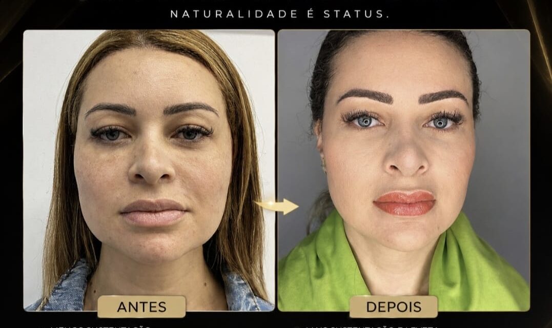 Emagrecimento e rosto e a preocupação de quando a perda de peso muda a face